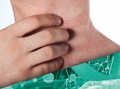 7. Alergia alimentaria-Imagen_XXV-JC
